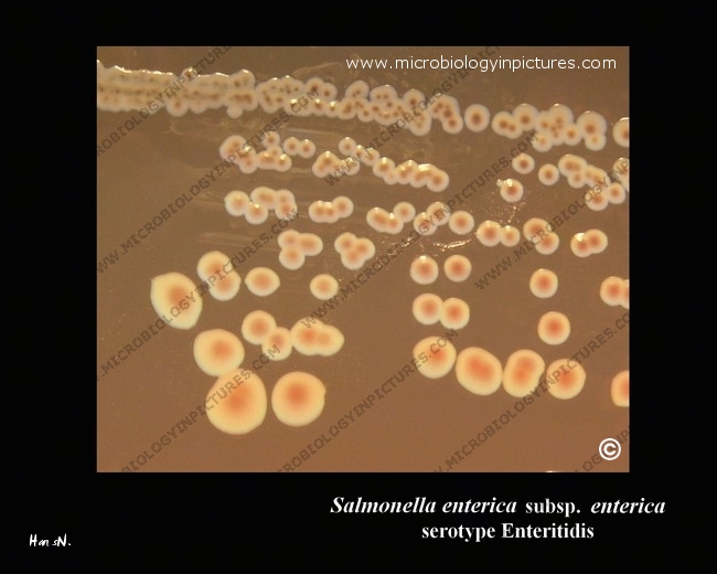 salmonella enterica colonies on Endo